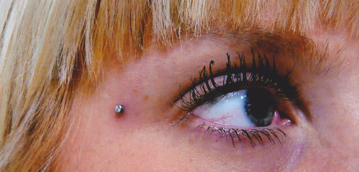 เจาะ Microdermal: วิธี microdermabras จะทำ (ภาพ)