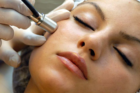  microdermabrasion