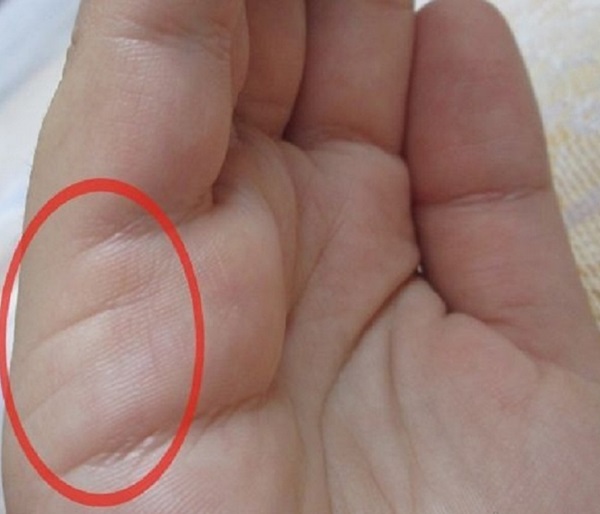 สายการสมรสในมือ