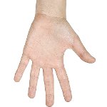 วิธีการกำจัดหูดที่มือของคุณ วิธีการกำจัดหูดที่มือของคุณ