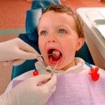 วิธีการรักษา stomatitis