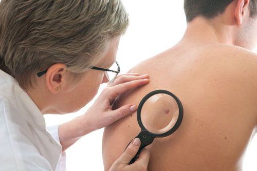 Birthmarks ในร่างกายและอันตรายของพวกเขา