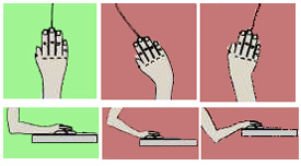 อุโมงค์ Syndrome