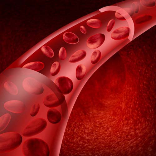 Vasculitis - มันคืออะไร? อาการรูปถ่ายการรักษา